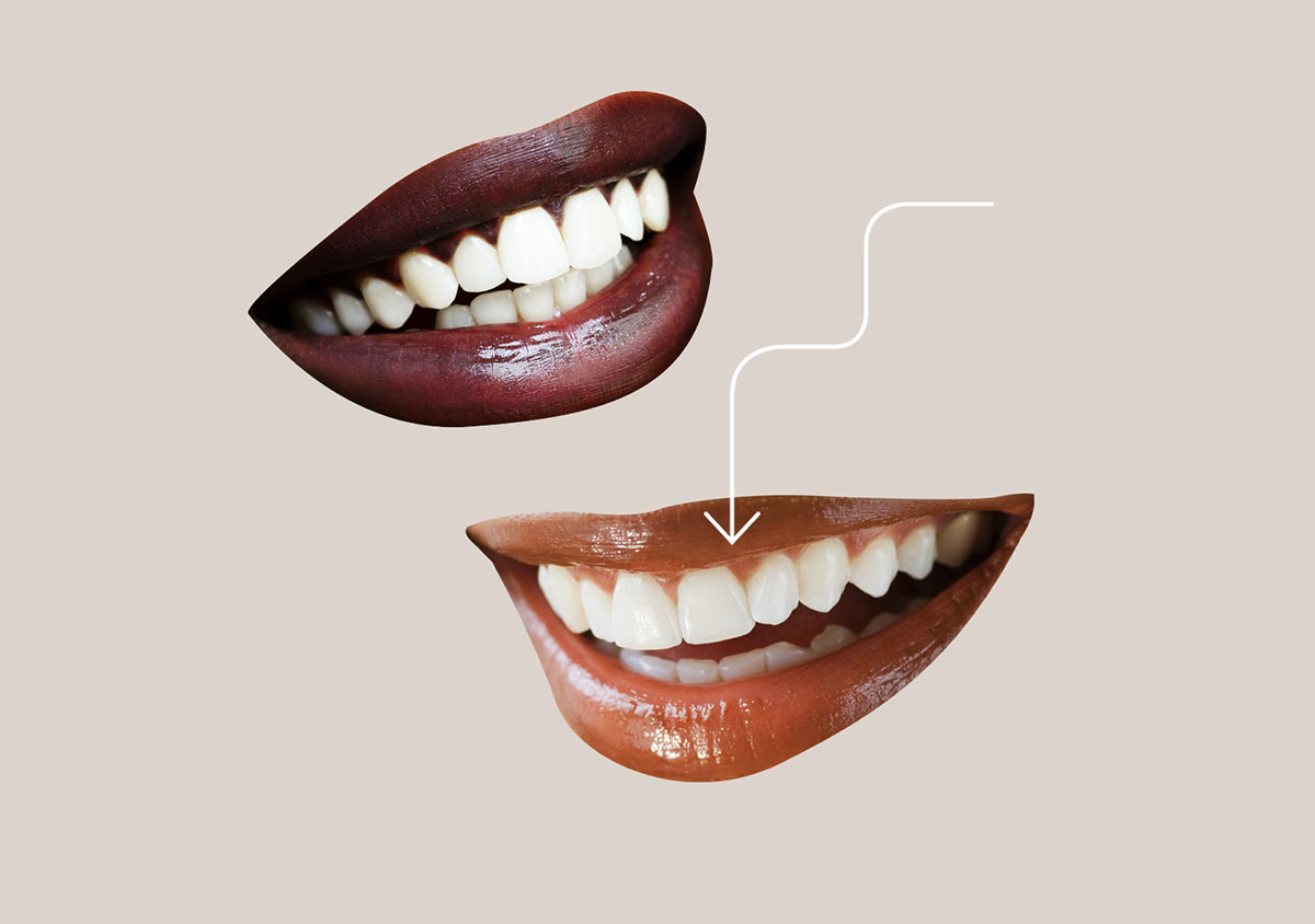 Cosmetic Dentistry